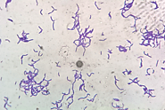 Lactobacillus plantarum