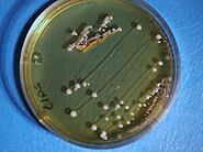 Lactobacillus brevis - harmful or friendly ?