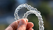 Top 5 Benefits of Invisalign Treatment You Need to Know