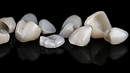 Top 5 Benefits of Dental Crowns