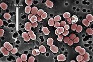 Pediococcus pentosaceus.