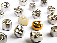 Everything You Need to Know About Dental Crowns - Smile Every Day Dentistry