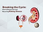 Breaking the Cycle: How to Break Free from Recurring Kidney Stones