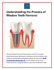 Know How Wisdom Teeth Extractions Is Done