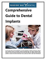 Comprehensive Guide to Dental Implants