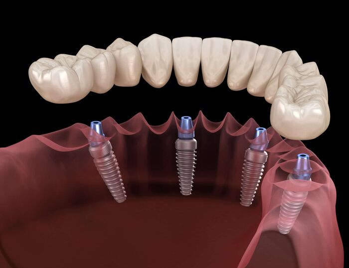 Relieving Discomfort: Understanding Toothache and Ear Pain on the Same ...