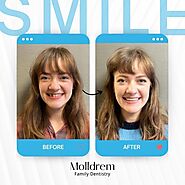 Revolutionizing Dental Care: Kevin Molldrem's Same-Day Cerec Crowns