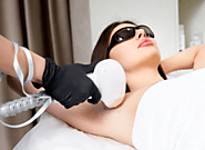 The ideal solution for hair removal using laser technology