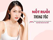 Nốt ruồi trong tóc mang ý nghĩa tướng số tốt hay xấu ở nam nữ