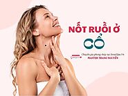 Nốt ruồi ở cổ đàn ông và phụ nữ mang điềm tốt hay xấu?