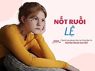 Nốt ruồi lệ là gì? Giải mã tướng số nốt ruồi hứng lệ ở nam và nữ