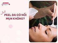 Peel da có đẩy mụn không? Có trị mụn nhanh hơn không?