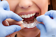 What to Expect During Your First Invisalign Appointment – Dr. Mohamed Ali Boukheir