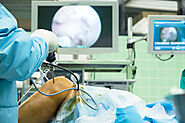 Myths & Facts about ACL Reconstruction Surgery in Delhi