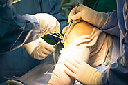 ACL Reconstruction Surgery in Delhi: Recovery Phases and Helpful Tips