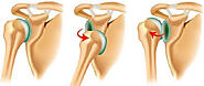 Best Orthopedic surgeon in Delhi - Dr. Vishwadeep Sharma