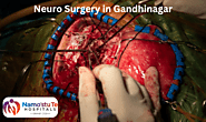 Neuro Surgery in Gandhinagar