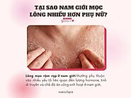 Tại sao lông mọc nhiều ở nam giới? Có cần phải tẩy không?