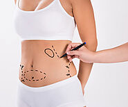 Liposuction Surgery in Delhi – Myths and Facts