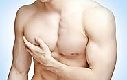 Gynecomastia Surgery: Let Us Discuss The Amazing Benefits Of Male Breast Reduction In Delhi