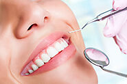 Which is more effective: Teeth Whitening or Teeth Bleaching?