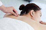 Get Relief Through Acupuncture Therapy