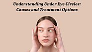 Understanding Under Eye Circles: Causes and Treatment Options