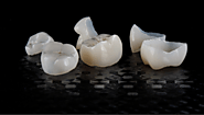 Top 5 Ways to Take Care of Your New Ceramic Crown Smile