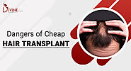 What Are The Dangers of Cheap Hair Transplant?