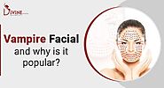 What is Vampire Facial and Why is it Popular?