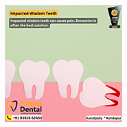 Impacted Wisdom Tooth Extraction - Platina Dental