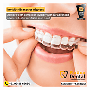 Invisible Braces or Aligners or Clear Braces in Hyderabad