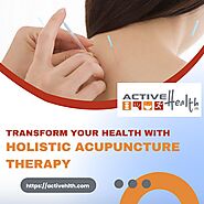 Transform Your Health with Holistic Acupuncture Therapy