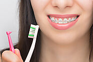 Essential Tips to Care for Dental Braces