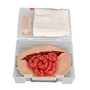 Ultrassist Wearable Abdominal Wound Small Bowel Evisceration