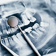 A Closer Look at the Top Innovators in the U.S. Dental Bone Graft Market