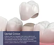 dental crowns