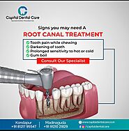 Root Canal Treatment in madinaguda | chanda nagar - CapitalDentalCare