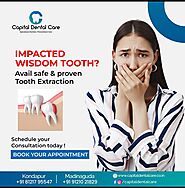 Wisdom Teeth Removal in madinaguda | chanda nagar - CapitalDentalCare