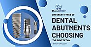 Different Types of Dental Abutments: Choosing the Right Option