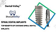 Top Benefits of Choosing Spiral Dental Implants for Tooth Replacement