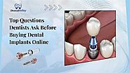 Top Questions Dentists Ask Before Buying Dental Implants Online