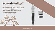 Maximizing Success: Tips for Implant Placement and Restoration