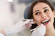 Understanding the Durability of Dental Fillings: Key Insights