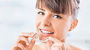 5 Things to Know Before Starting an Invisalign Treatment