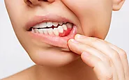 Shedding Light on Why Your Gums Are Bleeding