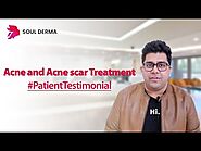 Acne Scar Treatment in South Delhi at Soul Derma Clinic