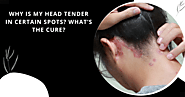 WHY IS MY HEAD TENDER IN CERTAIN SPOTS? WHAT’S THE CURE?