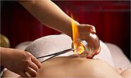 Role of Cupping and Trigger Point Therapy in Acupuncture - Dr. Ma Acupuncture Centre