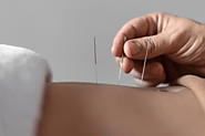 Acupuncture versus Massage: Exploring the Differences and Benefits